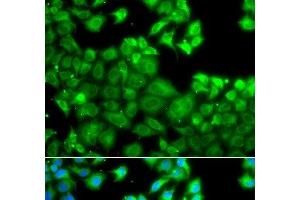 Immunofluorescence analysis of A549 cells using NLRC4 Polyclonal Antibody (NLRC4 anticorps)
