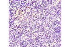 Immunohistochemistry of paraffin-embedded human lymph node tissue using ABIN7171353 at dilution of 1:100 (TCL1A anticorps  (AA 1-90))