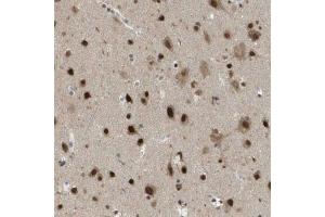 Immunohistochemical staining (Formalin-fixed paraffin-embedded sections) of human cerebral cortex using KAT5 polyclonal antibody  shows strong nuclear positivity in neurons. (KAT5 anticorps  (AA 150-286))