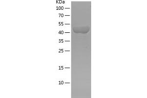 Western Blotting (WB) image for Actinin, alpha 1 (ACTN1) (AA 272-490) protein (His-IF2DI Tag) (ABIN7121663)