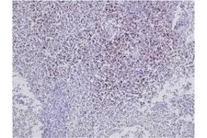 Immunohistochemistry (IHC) image for anti-CD8 (CD8) antibody (ABIN1449140) (CD8 anticorps)