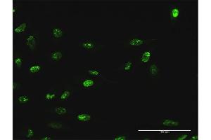 Immunofluorescence of purified MaxPab antibody to WDR18 on HeLa cell.