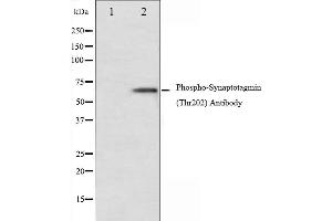 Western blot analysis of Synaptotagmin phosphorylation expression in Forskolin treated 293 whole cell lysates,The lane on the left is treated with the antigen-specific peptide.