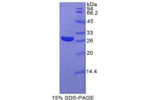 SDS-PAGE analysis of Rat Glypican 4 Protein. (GPC4 Protéine)