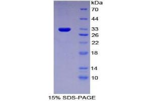 SDS-PAGE analysis of Rat IFNa/bR1 Protein. (IFNAR1 Protéine)