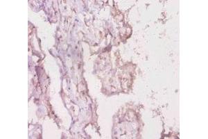 Immunohistochemistry of paraffin-embedded human placenta tissue using ABIN7158439 at dilution of 1:20 (LRBA anticorps  (AA 2-252))