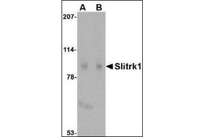 Western blot analysis of Slitrk1 in human brain tissue lysate with this product at (A) 1 and (B) 2 μg/ml. (SLITRK1 anticorps  (C-Term))