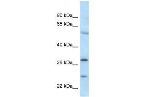 Western Blot showing MAD2L1BP antibody used at a concentration of 1 ug/ml against MDA-MB-435S Cell Lysate (MAD2L1BP anticorps  (N-Term))