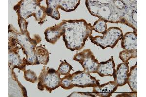 Immunoperoxidase of monoclonal antibody to TGM2 on formalin-fixed paraffin-embedded human placenta.