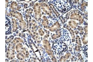 PHKG2 antibody was used for immunohistochemistry at a concentration of 4-8 ug/ml to stain Epithelial cells of renal tubule (Indicated with Arrows) in Human kidney.
