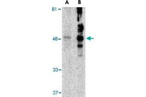 Western blot analysis of HAVCR1 in human uterus tissue lysate with HAVCR1 polyclonal antibody  at (A) 1 and (B) 2 ug/mL .