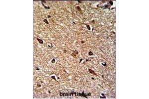 Formalin-fixed and paraffin-embedded human brain reacted with IDH1 Antibody (N-term), which was peroxidase-conjugated to the secondary antibody, followed by DAB staining.