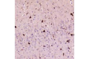 IHC analysis of Cystatin C using anti-Cystatin C antibody (ABIN5692829). (CST3 anticorps  (AA 31-146))