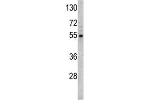 Western blot analysis of Fascin antibody and Y79 lysate.