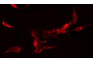 ABIN6278463 staining  Hela cells by IF/ICC. (FLT3 anticorps  (C-Term))