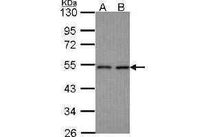CLP1 anticorps  (Center)