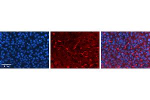 Rabbit Anti-GNS Antibody   Formalin Fixed Paraffin Embedded Tissue: Human Liver Tissue Observed Staining: Cytoplasm in Kupffer cells in sinusoids Primary Antibody Concentration: 1:100 Other Working Concentrations: N/A Secondary Antibody: Donkey anti-Rabbit-Cy3 Secondary Antibody Concentration: 1:200 Magnification: 20X Exposure Time: 0.