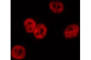 ABIN6267014 staining Hela by IF/ICC.