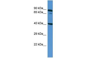 Host: Rabbit Target Name: ZDHHC11B Sample Type: NCI-H226 Whole cell lysates Antibody Dilution: 1. (ZDHHC11B anticorps  (N-Term))