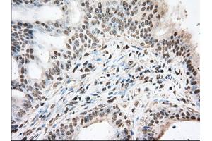Immunohistochemical staining of paraffin-embedded Human prostate tissue using anti-BAT1 mouse monoclonal antibody. (BAT1 anticorps)