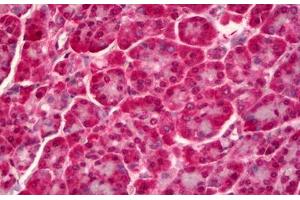Anti-PTPN22 antibody IHC staining of human pancreas. (PTPN22 anticorps)