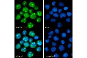 (ABIN7505820) Immunofluorescence analysis of paraformaldehyde fixed Jurkat cells, permeabilized with 0. (NCOR1 anticorps)