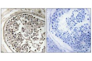 Immunohistochemistry analysis of paraffin-embedded human testis tissue using MRPS5 antibody. (MRPS5 anticorps  (C-Term))