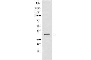 Western blot analysis of extracts from HepG2 cells using RPL5 antibody. (RPL7 anticorps  (C-Term))