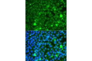 Immunofluorescence analysis of  cells using GB antibody (ABIN6131369, ABIN6140990, ABIN6140991 and ABIN6223796). (GBA3 anticorps  (AA 1-162))