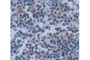 IHC-P analysis of Rat Tissue, with DAB staining. (CXCL9 anticorps  (AA 22-125))