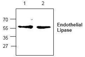 Image no. 1 for anti-Lipase, Endothelial (LIPG) antibody (ABIN127288) (LIPG anticorps)