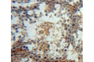 Used in DAB staining on fromalin fixed paraffin-embedded Testis tissue (WFDC2 anticorps  (AA 30-124))