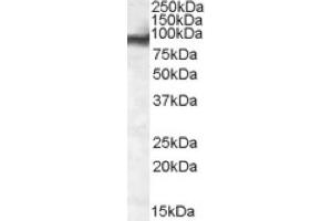 Image no. 1 for anti-Ewing Sarcoma Breakpoint Region 1 (EWSR1) (Internal Region) antibody (ABIN375098) (EWSR1 anticorps  (Internal Region))