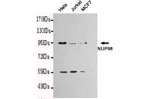 Western blot detection of NUP98 in Hela,Jurkat and MCF7 cell lysates using NUP98 mouse mAb (1:1000 diluted). (NUP98 anticorps)