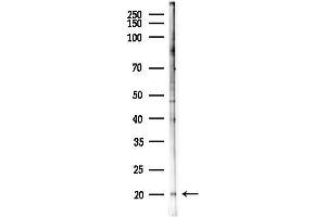anti-Insulin-Like 4 (Placenta) (INSL4) (Internal Region) antibody