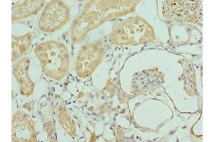 Immunohistochemistry of paraffin-embedded human kidney tissue using ABIN7156394 at dilution of 1:100 (INTS1 anticorps  (AA 451-710))