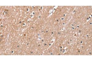 Immunohistochemistry of paraffin-embedded Human brain using RAB8A Polyclonal Antibody at dilution of 1:45