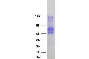 Validation with Western Blot