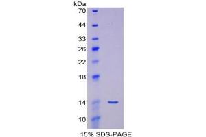 SDS-PAGE of Protein Standard from the Kit (Highly purified E.