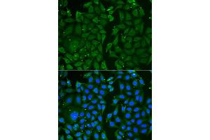 Immunofluorescence (IF) image for anti-Transketolase (TKT) antibody (ABIN1980330) (TKT anticorps)