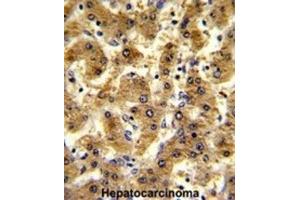 Immunohistochemistry (IHC) image for anti-Alcohol Dehydrogenase 1B (Class I), beta Polypeptide (ADH1B) antibody (ABIN3002782)