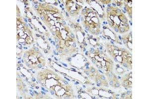 Immunohistochemistry of paraffin-embedded Mouse kidney using AIP Polyclonal Antibody at dilution of 1:100 (40x lens). (AIP anticorps)
