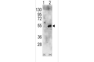 Western blot analysis of RPS6KB2 (arrow) using rabbit polyclonal RPS6KB2 Antibody (Center) (R). (RPS6KB2 anticorps  (AA 243-272))