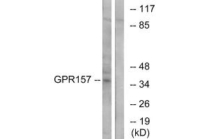 Western blot analysis of extracts from NIH-3T3 cells, using GPR157 antibody. (GPR157 anticorps  (Internal Region))