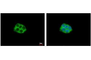 ICC/IF Image RPL5 antibody detects RPL5 protein at Cytoplasm by immunofluorescent analysis.