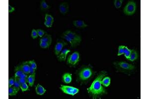 Immunofluorescent analysis of MCF-7 cells using ABIN7164481 at dilution of 1:100 and Alexa Fluor 488-congugated AffiniPure Goat Anti-Rabbit IgG(H+L)