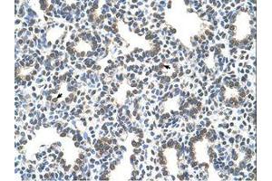 Image no. 1 for anti-Solute Carrier Family 43, Member 3 (SLC43A3) (N-Term) antibody (ABIN205016)