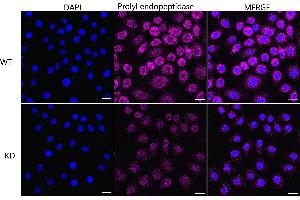 Immunocytochemical staining of HeLa cells using Prolyl endopeptidase like antibody (ABIN7799923), 1:1,000), Top panel: wild-type (WT), Bottom panal: Prolyl endopeptidase like shRNA knockdown (KD). (Recombinant PREPL anticorps)