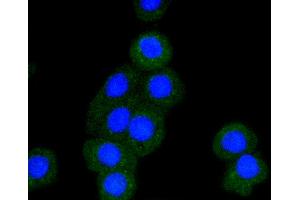 Immunofluorescence analysis of CRC cells using BAK1 antibody (ABIN5996915). (BAK1 anticorps)