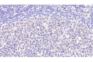 Detection of IL6 in Human Lymph node Tissue using Polyclonal Antibody to Interleukin 6 (IL6)